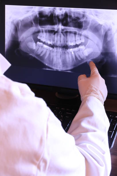 Best Emergency Wisdom Teeth Removal in Blue Springs, MO